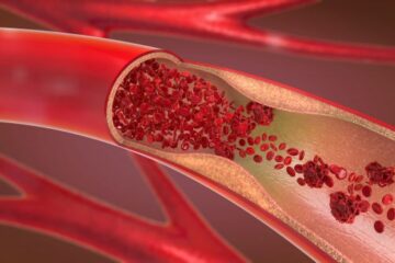 Bio-medical (Blood Flow)