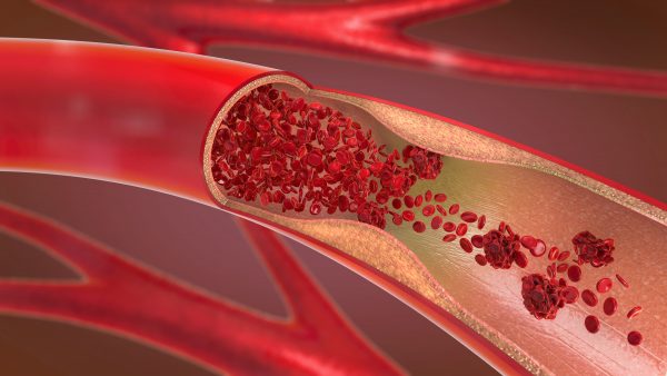 Cardiovascular Biomechanics Lab Bio-medical (Blood Flow)